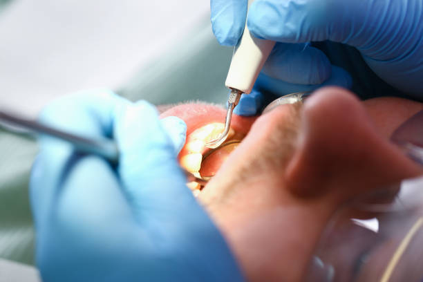 Best Pediatric Emergency Dentist in Algonquin, IL