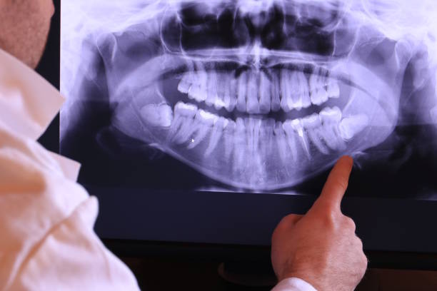 Best Orthodontic Emergency Dentist in Algonquin, IL